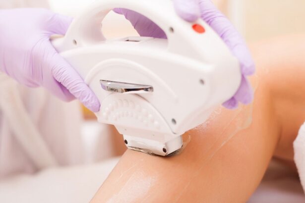 Dauerhafte Haarentfernung mit dem Diodenlaser - Belle-Belle Kosmetik